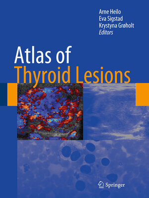 cover image of Atlas of Thyroid Lesions